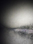 Anals