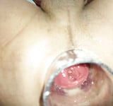 anal soi 2