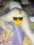 Cu mình bự nguyên nhân là do 🤭😀🥵